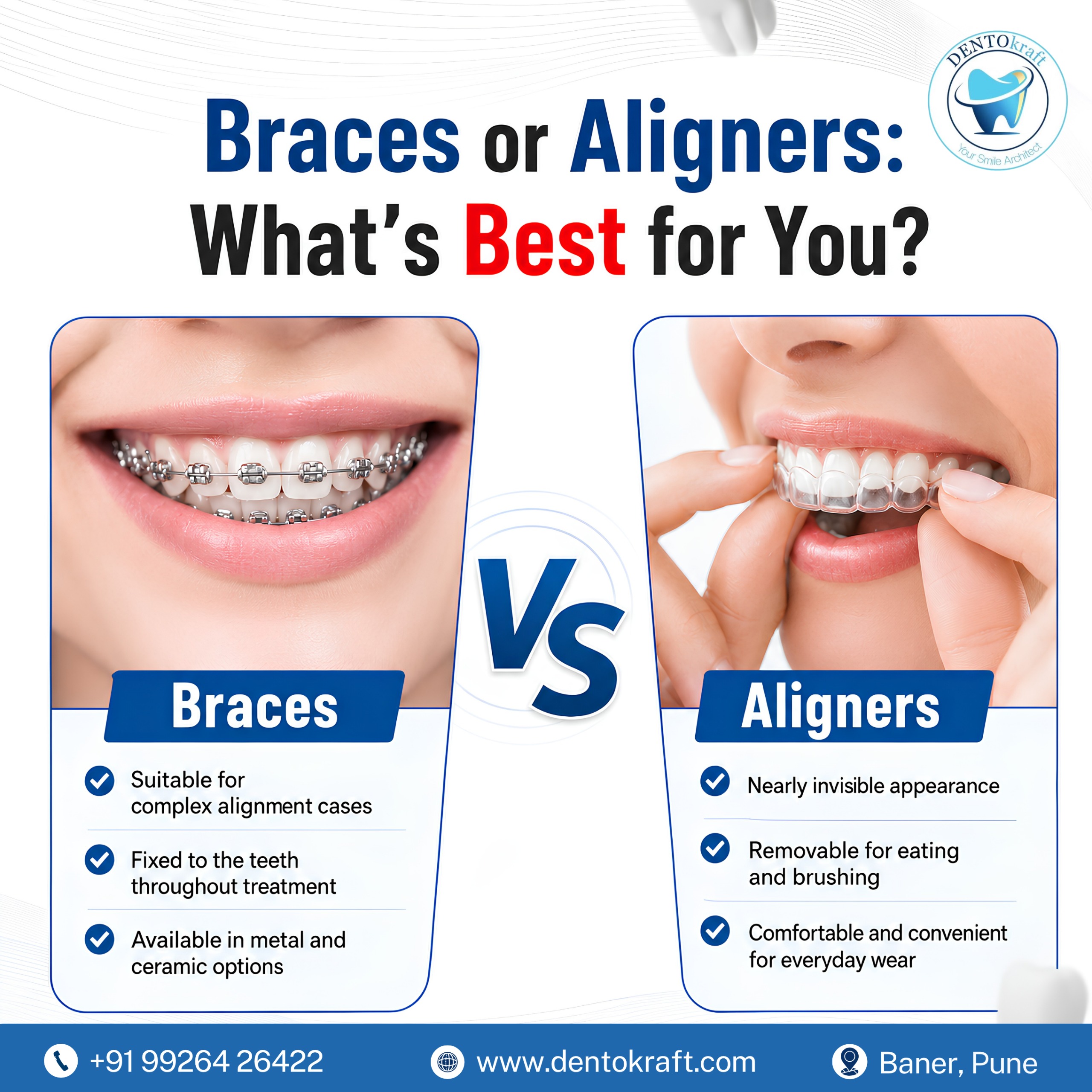  Braces or Aligners: What’s Best for You?