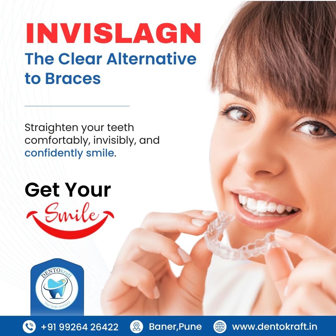 Invisalign – The Clear Alternative to Braces